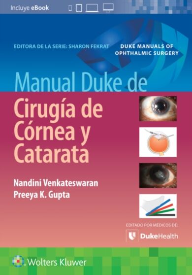 Manual Duke de cirugia de cornea y catarata