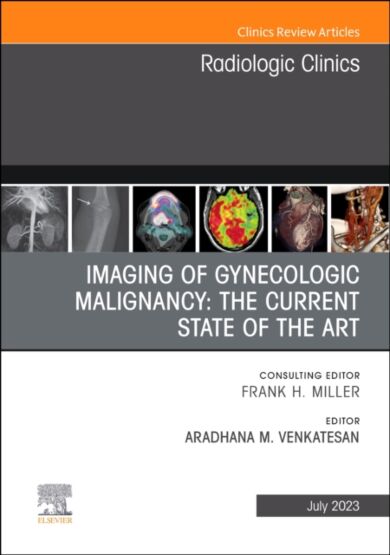 Imaging of Gynecologic Malignancy: The Current State of the Art, An Issue of Radiologic Clinics of N