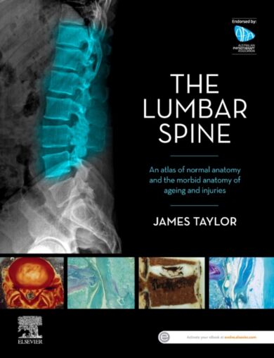 The Lumbar Spine