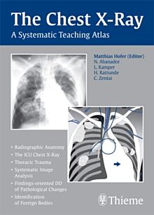 The Chest X-Ray