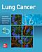 Lung Cancer:  Standards of Care