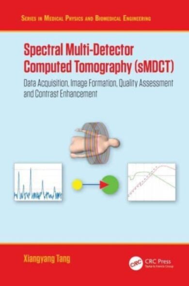 Spectral Multi-Detector Computed Tomography (sMDCT)