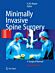 Minimally Invasive Spine Surgery