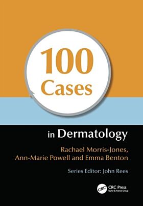 100 Cases in Dermatology