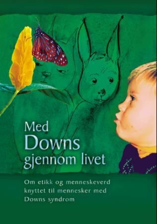 Med Downs gjennom livet