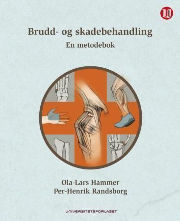 Brudd- og skadebehandling