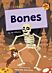 Bones