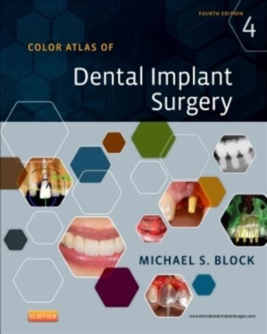 Color Atlas of Dental Implant Surgery