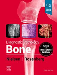 Diagnostic Pathology: Bone