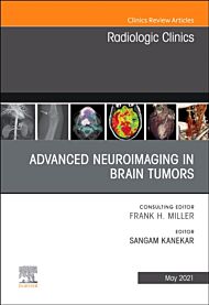 Advanced Neuroimaging in Brain Tumors, An Issue of Radiologic Clinics of North America