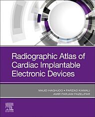 Radiographic Atlas of Cardiac Implantable Electronic Devices