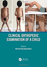 Clinical Orthopedic Examination of a Child