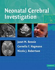 Neonatal Cerebral Investigation