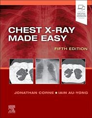 Chest X-Ray Made Easy