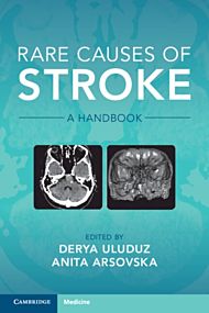 Rare Causes of Stroke