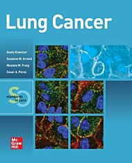 Lung Cancer:  Standards of Care