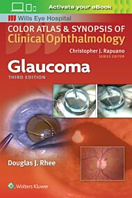 Glaucoma