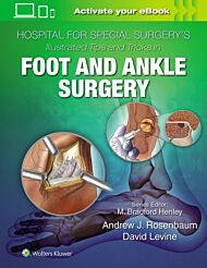 Hospital for Special Surgery's Illustrated Tips and Tricks in Foot and Ankle Surgery