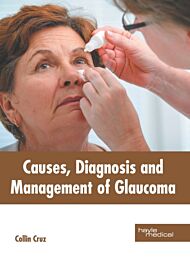 Causes, Diagnosis and Management of Glaucoma