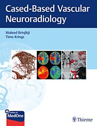 Imaging in Neurovascular Disease