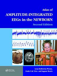 An Atlas of Amplitude-Integrated EEGs in the Newborn