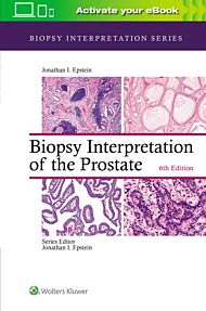 Biopsy Interpretation of the Prostate