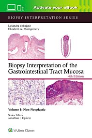 Biopsy Interpretation of the Gastrointestinal Tract Mucosa Volume 1