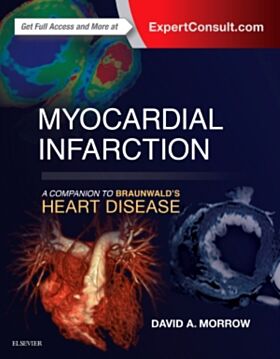 Myocardial Infarction: A Companion to Braunwald's Heart Disease