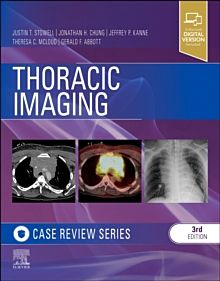 Thoracic Imaging: Case Review