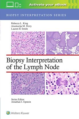 Biopsy Interpretation of the Lymph Node