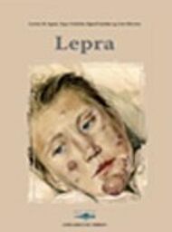 Leprosy