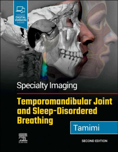 Specialty Imaging: Temporomandibular Joint and Sleep-Disordered Breathing