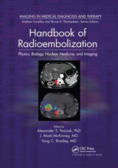 Handbook of Radioembolization