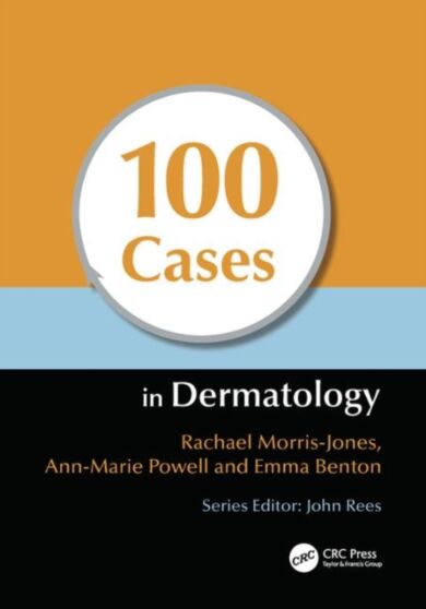 100 Cases in Dermatology