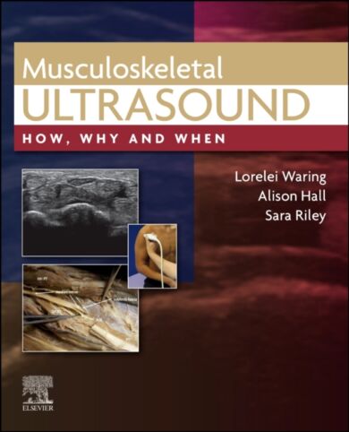 Musculoskeletal Ultrasound